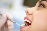 Ультразвуковое удаление наддесневых зубных отложений (1 зуб)