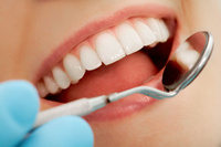 Восстановление зуба пломбой при кариесе