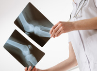 Дентальный рентгеновский снимок (скидка 34% для пациентов "СМ-Стоматология)